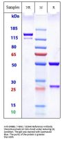Anti-ERBB2 / HER2 / CD340 Reference Antibody (Hersintuzumab)