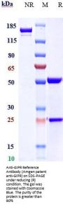 Anti-GIPR Reference Antibody (Amgen patent anti-GIPR)