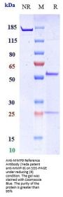 Anti-MMP9 Reference Antibody (Yeda patent anti-MMP-9)