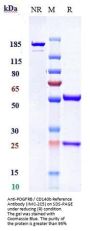 Anti-PDGFRB / CD140b Reference Antibody (IMC-2C5)