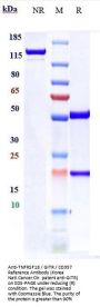 Anti-TNFRSF18 / GITR / CD357 Reference Antibody (Korea Natl.Cancer Ctr. patent anti-GITR)