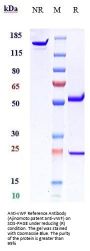 Anti-vWF Reference Antibody (Ajinomoto patent anti-vWF)
