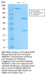 ACPP Recombinant Antibody AE00101