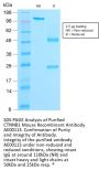 CTNNB1 Recombinant Antibody AE00113
