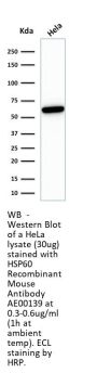 HSP60 Recombinant Antibody AE00139