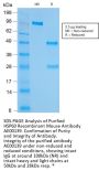 HSP60 Recombinant Antibody AE00139