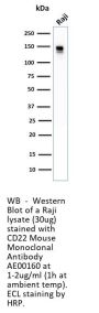 CD22 Monoclonal Antibody AE00160