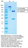 S100B Recombinant Antibody AE00287