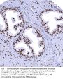 Androgen Receptor Recombinant Antibody AE00344