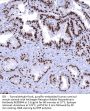 Androgen Receptor Recombinant Antibody AE00344