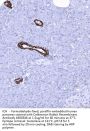 Caldesmon Recombinant Antibody AE00346