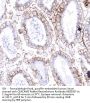 CEACAM5 Recombinant Antibody AE00357