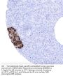 CHGA Recombinant Antibody AE00359