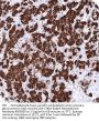 CHGA Recombinant Antibody AE00359