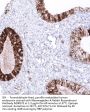 Mammaglobin-A Recombinant Antibody AE00372