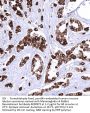 Mammaglobin-A Recombinant Antibody AE00372