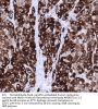 Melan A Recombinant Antibody AE00375