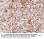 PD-L1 Recombinant Antibody AE00385