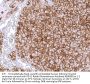 PD-L1 Recombinant Antibody AE00385