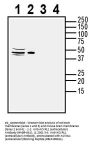 Anti-ACVRL1 (extracellular) Antibody