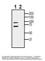 Anti-BMPR1A (extracellular) Antibody