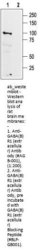 Anti-GABA (B) R1