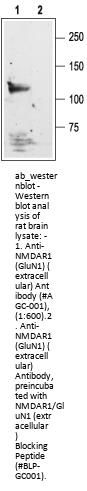 Anti-NMDA Receptor 1 (GluN1) (ext.)