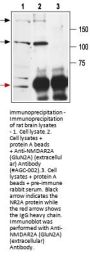 Anti-NMDA Receptor 2A (GluN2A) (extracellular)