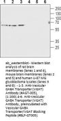 Anti-Vesicular GABA Transporter