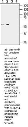 Anti-SLC6A14 (extracellular)
