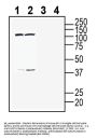 Anti-CLEC7A/Dectin-1 (extracellular) Antibody