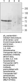 Anti-Noradrenaline Transporter (NET) (ext.)