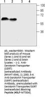 Anti-Serotonin Transporter (SERT) (extracellular