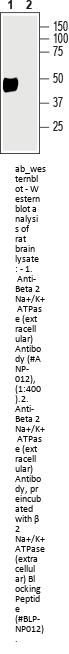 Anti-Beta 2 Na+/K+ ATPase (extracellular)
