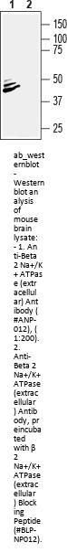 Anti-Beta 2 Na+/K+ ATPase (extracellular)
