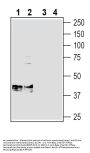 Anti-Beta 1 Na+/K+ ATPase (extracellular) Antibody