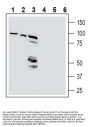 Anti-Beta 1 Na+/K+ ATPase (extracellular) Antibody