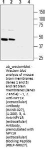 Anti-NPY1R (extracellular)