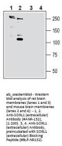 Anti-SORL1 (extracellular)