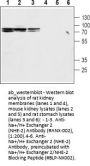 Anti-Na+/H+ Exchanger 2 (NHE-2)