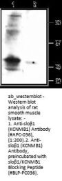 Anti-slobeta1 (KCNMB1)