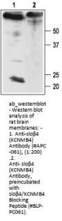 Anti-slobeta4 (KCNMB4)