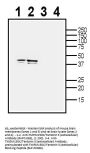 Anti-TMEM150C/Tentonin 3 (extracellular) Antibody