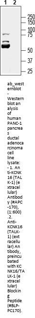 Anti-K2P16.1 (TALK-1) (extracellular)