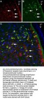 Guinea pig Anti-SCN2A (NaV1.2) Antibody