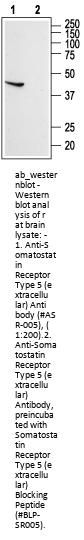 Anti-Somatostatin Receptor Type 5 (ext.)