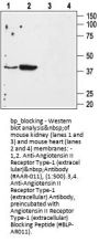 Angiotensin II Rec Type-1 (ext) Blocking Peptide