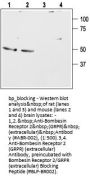 Bombesin Receptor 2/GRPR (ext) Blocking Peptide
