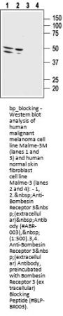 Bombesin Rece 3 (extracellular) Blocking Peptide