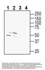 Cannabinoid Receptor 1 (ext) Blocking Peptide